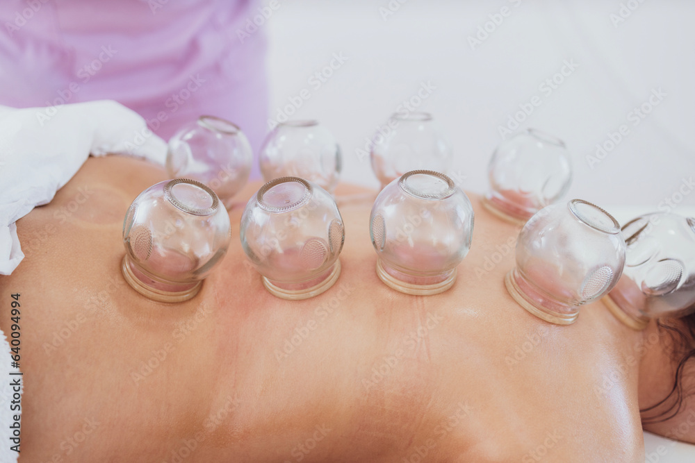 Professional female therapist doing hijama treatment on patient back. Putting heated vacuum cups to heal chronic pain. Professional female therapist doing hijama treatment on patient back. Putting heated vacuum cups to heal chronic pain.
