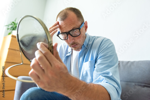 Obraz na płótnie A worried white man looks at himself in the mirror and inspects his premature receding hairline