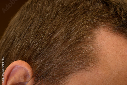 Zbliżenie na siwiejące  włosy na głowie u młodego mężczyzny