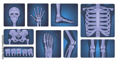 X-ray shots. Human skeleton and body parts, medical diagnosis and healthcare concept, anatomy and science vector set