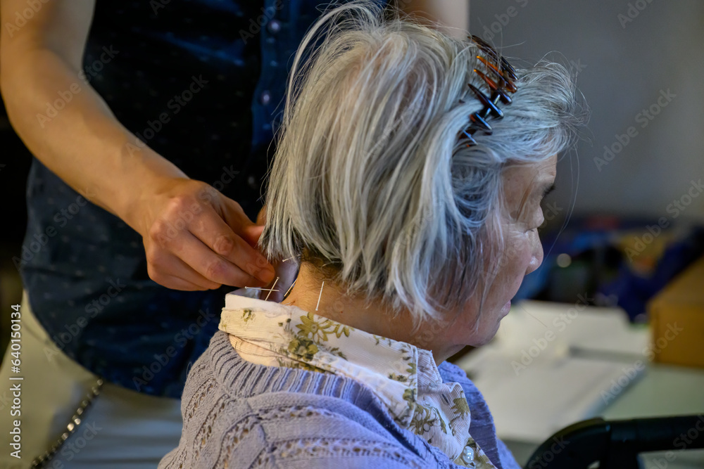 Senior woman receiving acupuncture therapy at home with steel needles on her neck. Home visit by a young doctor of traditional Chinese medicine.