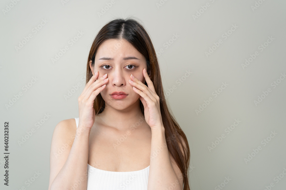 lack of sleep problem, Worried Asian young woman pointing finger at dark circles under her eyes lack of sleep problem, Worried Asian young woman pointing finger at dark circles under her eyes