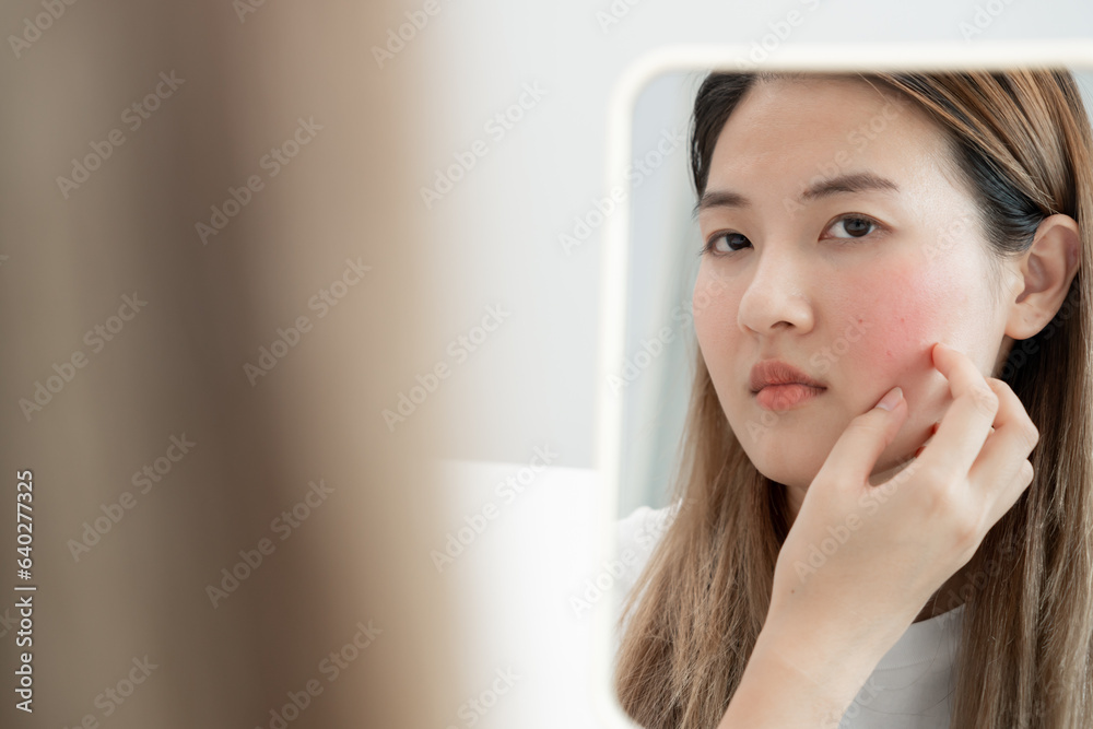 Young woman are worried about faces Dermatology and allergic to steroids in cosmetics. sensitive skin, red face from sunburn, acne, allergic to chemicals, rash on face. skin problems and beauty Young woman are worried about faces Dermatology and allergic to steroids in cosmetics. sensitive skin, red face from sunburn, acne, allergic to chemicals, rash on face. skin problems and beauty