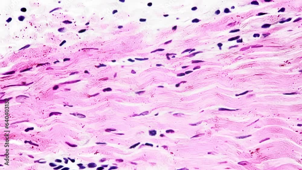 White fibrous tissue of human being filmed under microscope 400x on bright field background. Isolated macro of dense regular connective layers consisting of fibroblasts and having strong structure.