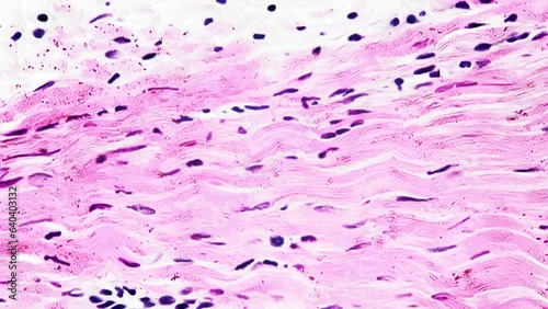 White fibrous tissue of human being filmed under microscope 400x on bright field background. Isolated macro of dense regular connective layers consisting of fibroblasts and having strong structure. photo
