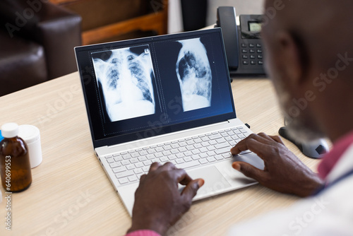 African american male doctor using laptop with radiograph on screen at doctor's office
