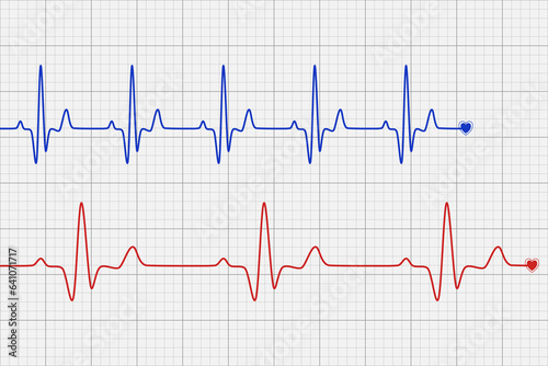 Blue and red heartbeat diagram on grey graph paper for Cardio test line. Minimal Vector Design.