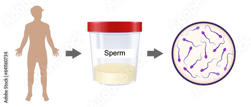 Male reproductive system. Semen analysis vector. Medical Sample in Glass Tube. Sample sperm. Donor Sperm.