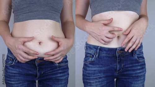 Obesity Cellulite. Folds of excess fat on woman waist. Before and after. Concept of losing weight, playing sports, checking result from diet and intense training. Result of losing weight. Liposuction
