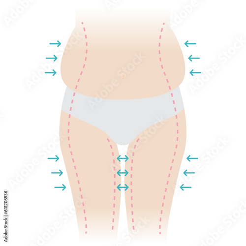 Woman body fat vector illustration isolated on white background. The woman fat belly, hip and thigh with arrows, dotted lines on skin. Weight, liposuction, cellulite removal, skin lifting concept.