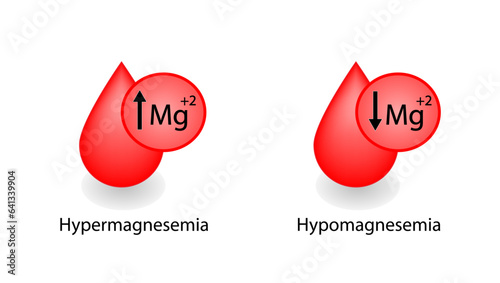 	
hypermagnesemia, high plasma magnesium level and hypomagnesemia, low plasma magnesium level. magnesium Mg excess and deficit electrolyte disorders, blood test tube, Scientific vector