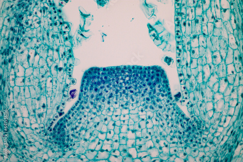 The study of plant tissues under the microscope in the laboratory. photo