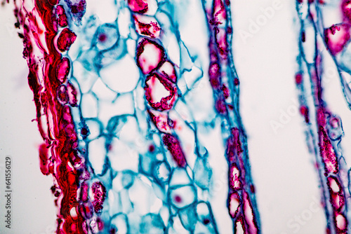 The study of plant tissues under the microscope in the laboratory. photo