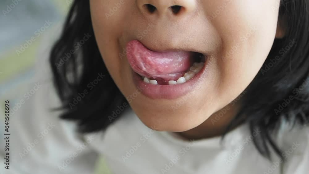 child shows his tongue closeup child shows his tongue closeup