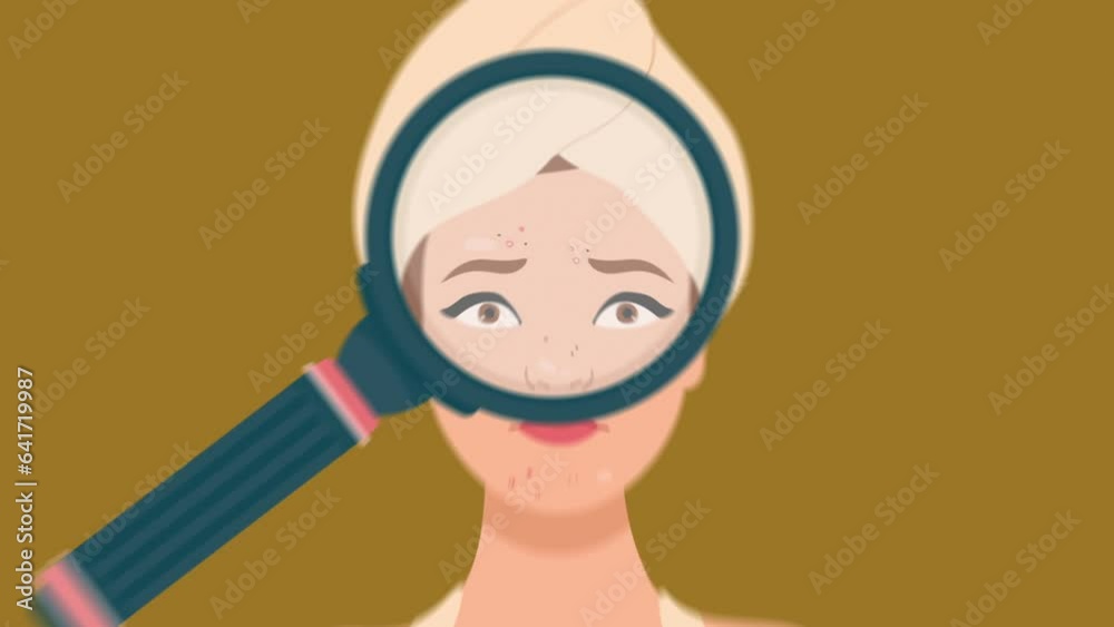 2d graphic animation of a woman with severe acne holding a magnifying glass to zoom on the spots with a yellow screen background 2d graphic animation of a woman with severe acne holding a magnifying glass to zoom on the spots with a yellow screen background