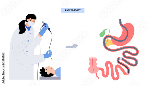 Esophagogastroduodenoscopy medical procedure