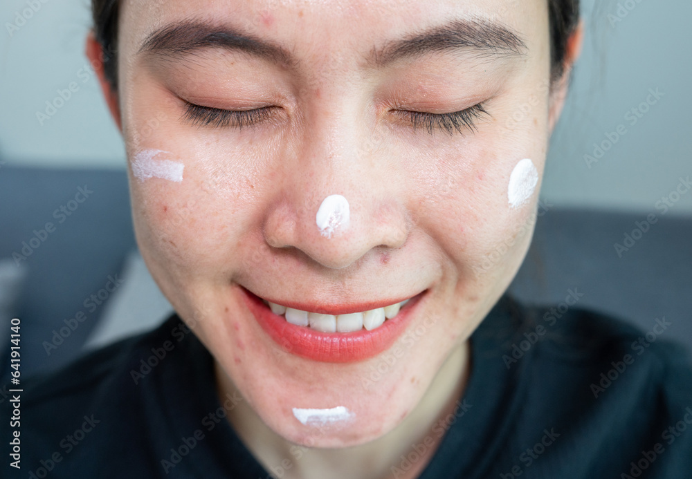 Asian woman smiling after she applying acne cream on her face for ...