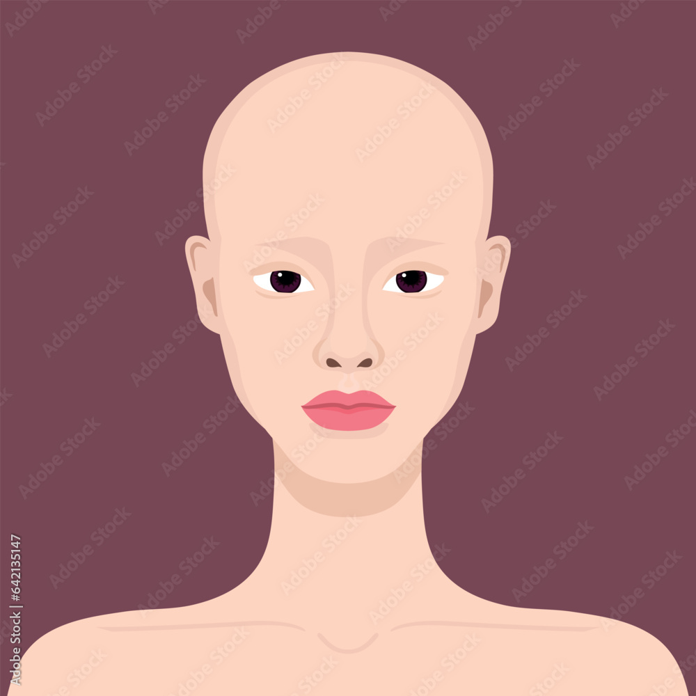 Young woman with alopecia. Beautiful bald girl. Alopecia areata. Vector illustration