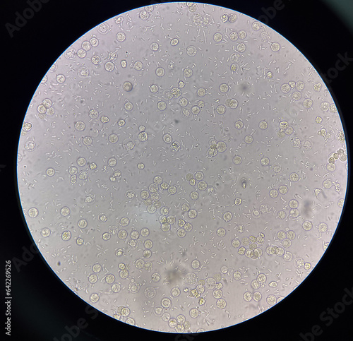 Fresh bacteria cell in urine sample.