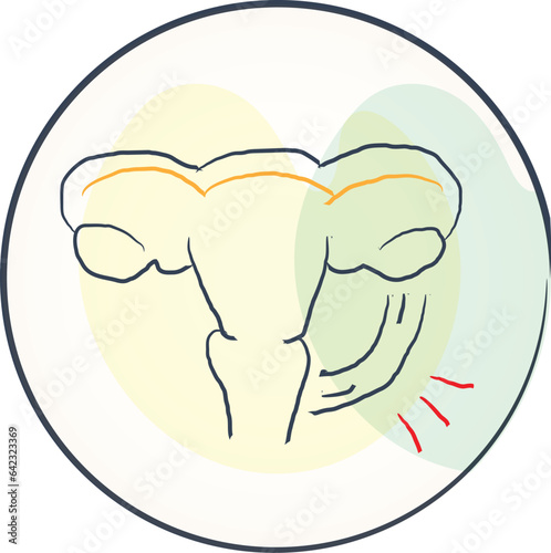 Laparoscopy Surgery for Endometriosis. Doctors can diagnose and treat endometriosis with a laparoscopy