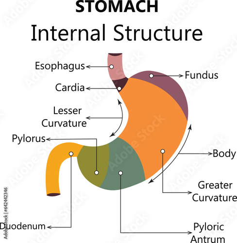 Gastroesophageal reflux disease stomach with main parts labeled. Medical vector illustration with the shape of a sick human body, fragments of healthy and sick stomach isolated on a white background