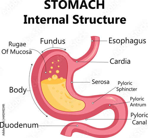 Gastroesophageal reflux disease stomach with main parts labeled. Medical vector illustration with the shape of a sick human body, fragments of healthy and sick stomach isolated on a white background