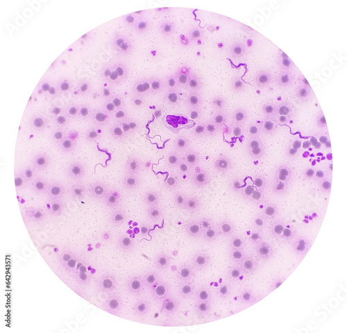 Trypanosoma sp. among red blood cells. Trypanosome species in blood from cattle.  Trypanosoma is a protozoan parasite that is the causative agent of the animal disease trypanosomiasis or ‘Surra’