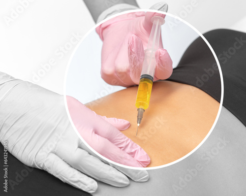 Aesthetic cosmetology doctor makes injections against stretch marks on the woman s abdomen and body. Women s aesthetic cosmetology in a beauty salon.