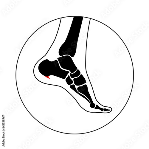 Heel spur icon