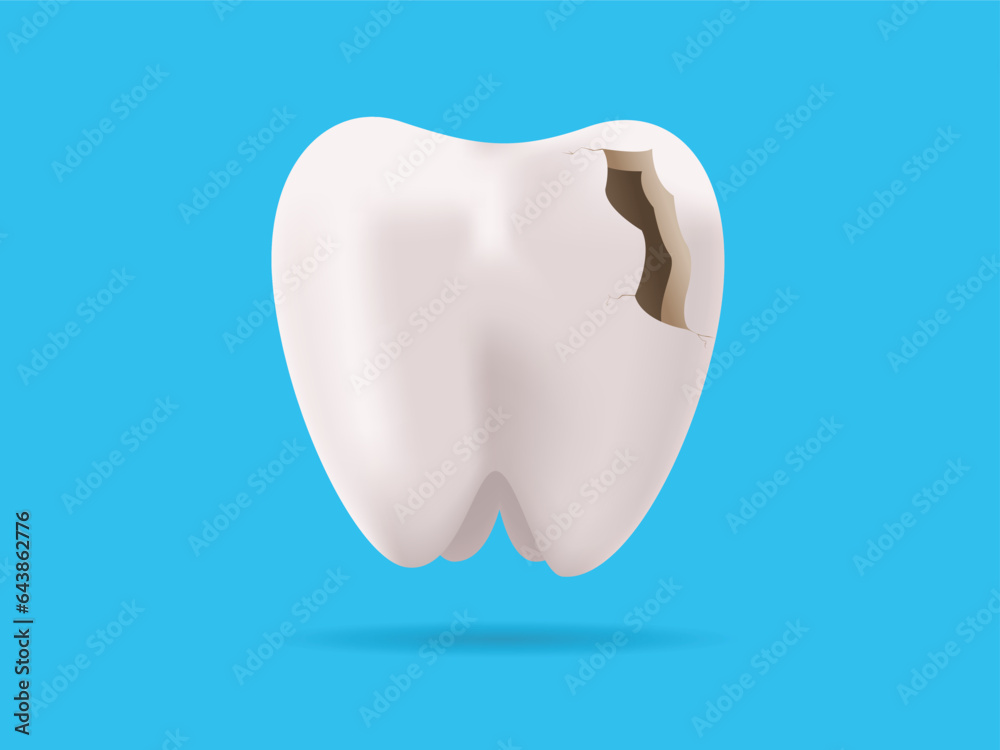 Cracked tooth. 3D realistic of cracked tooth vector illustration. dental care Cracked tooth. 3D realistic of cracked tooth vector illustration. dental care