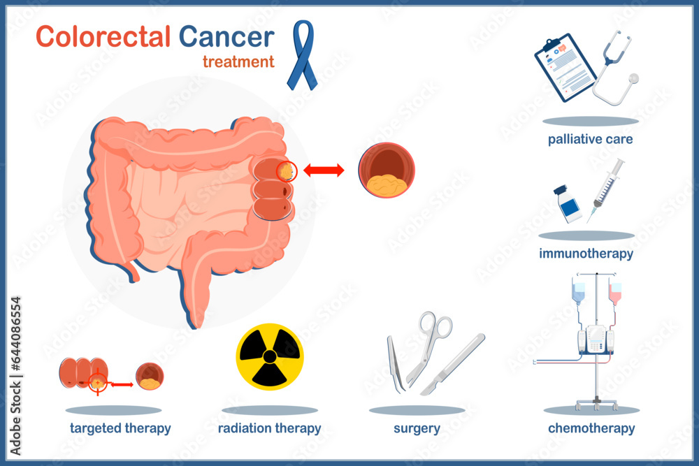 medical-vector-illustration-concept-human-colon-and-colon-cancer