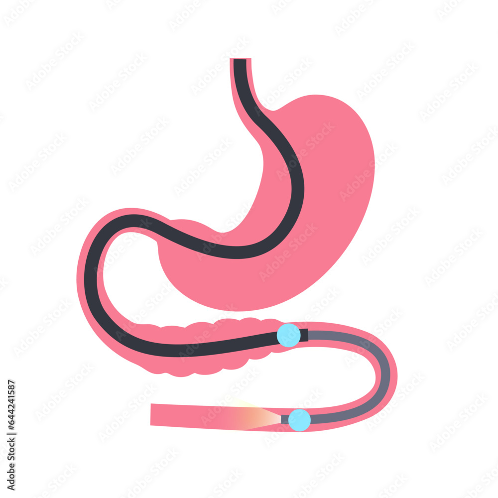 Double balloon enteroscopy Double balloon enteroscopy
