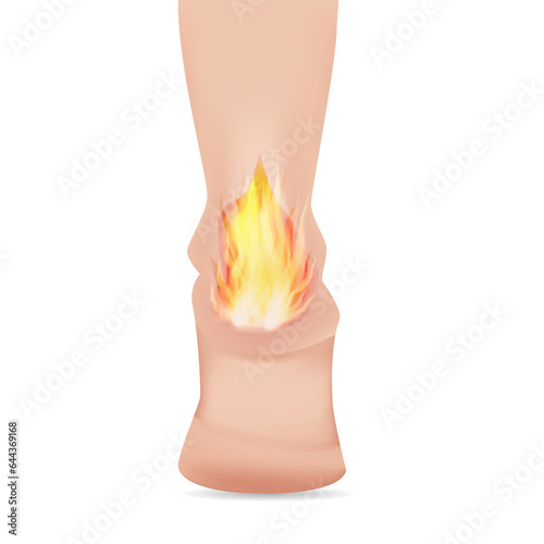 Heel spur, aches, hot burn sensation. Vector illustrations.