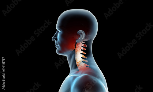 x ray of cervical section of the spine photo