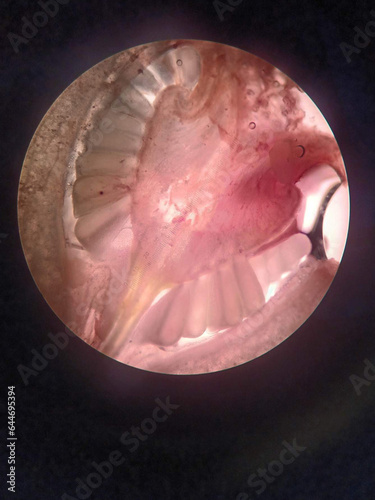 Inthanin ovule