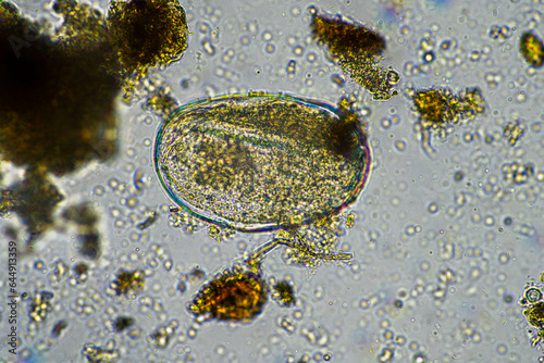 microbial organisms under the microscope in a lab