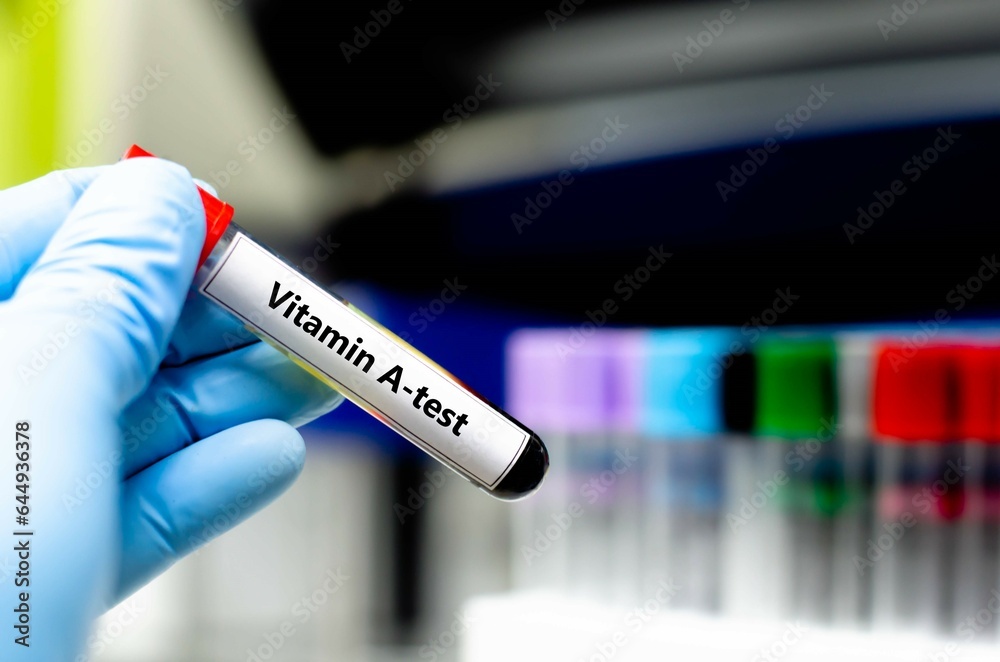 Blood sampling tube for vitamin A analysis. Blood sampling tube for vitamin A analysis.