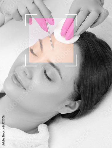 A procedure for cleansing the skin of the face from blackheads and acne. Cosmetologist treats problematic skin of a young woman's face in a beauty salon. Aesthetic cosmetology and makeup concept.