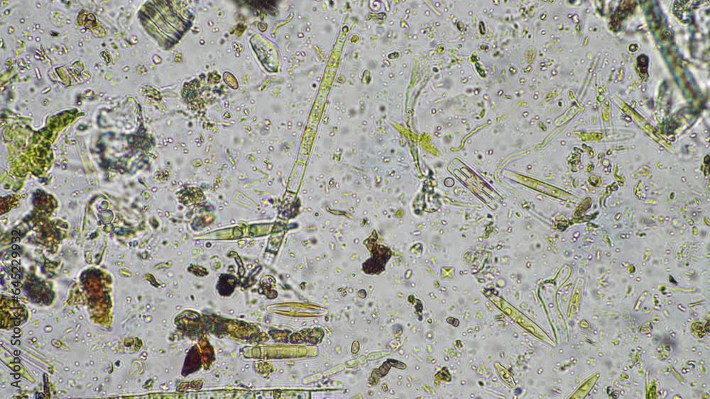 soil microbes organisms in a soil and compost sample, fungus and fungi ...