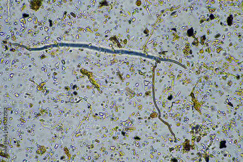 soil microorganisms close up under the microscope. in a soil samlple photo