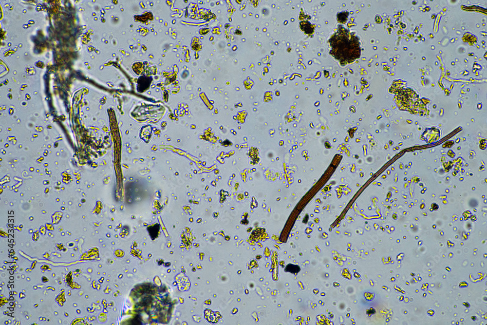 soil microorganisms close up under the microscope. in a soil samlple ...