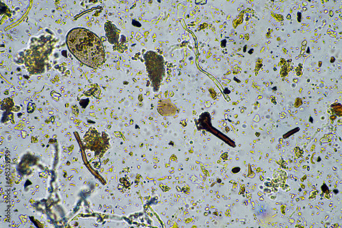 soil microorganisms close up under the microscope. in a soil samlple photo