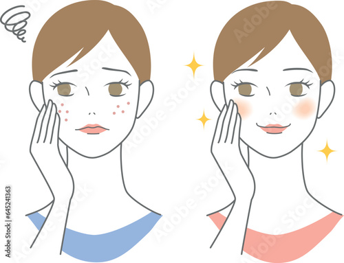 肌荒れに悩む女性と綺麗な肌の女性