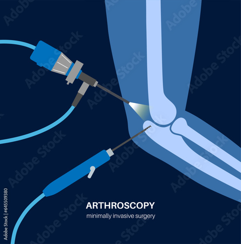 Elbow arthroscopy surgery