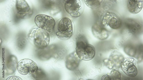 Larvae veliger Mollusca in a clutch of eggs under microscope, class Gastropoda. White sea photo