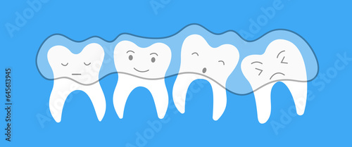 Flat cute ragged teeth with clear aligners. Dental orthodontic treatment. Oral hygiene concept for children for pediatric dentistry. Teeth cleaning and prevention. Vector hand draw illustration.