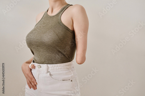 Fotografie Close-up of young woman with amputee hand standing against white background