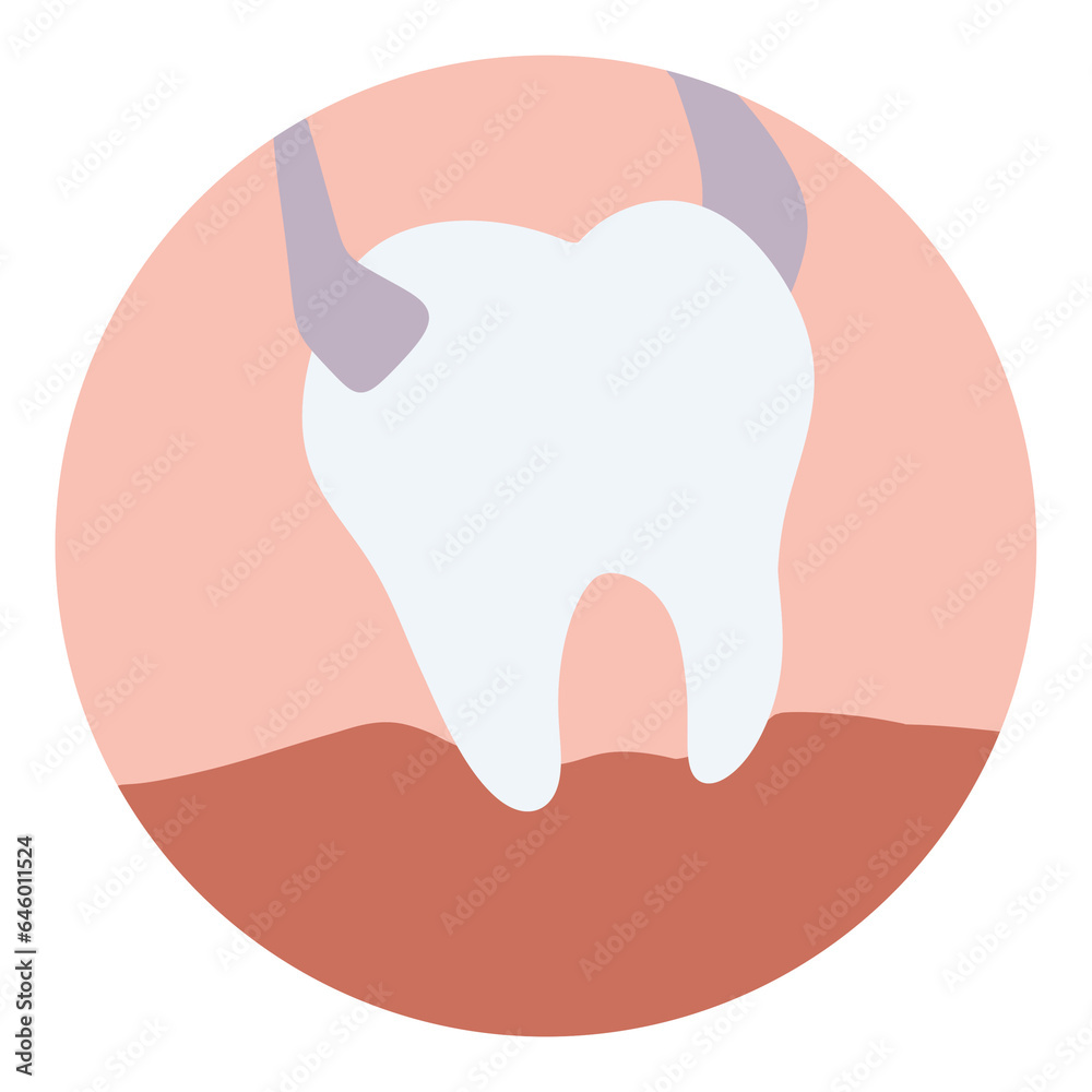 Illustration tooth is removed by forceps in oral cavity. toothaches tooth extraction Illustration tooth is removed by forceps in oral cavity. toothaches tooth extraction