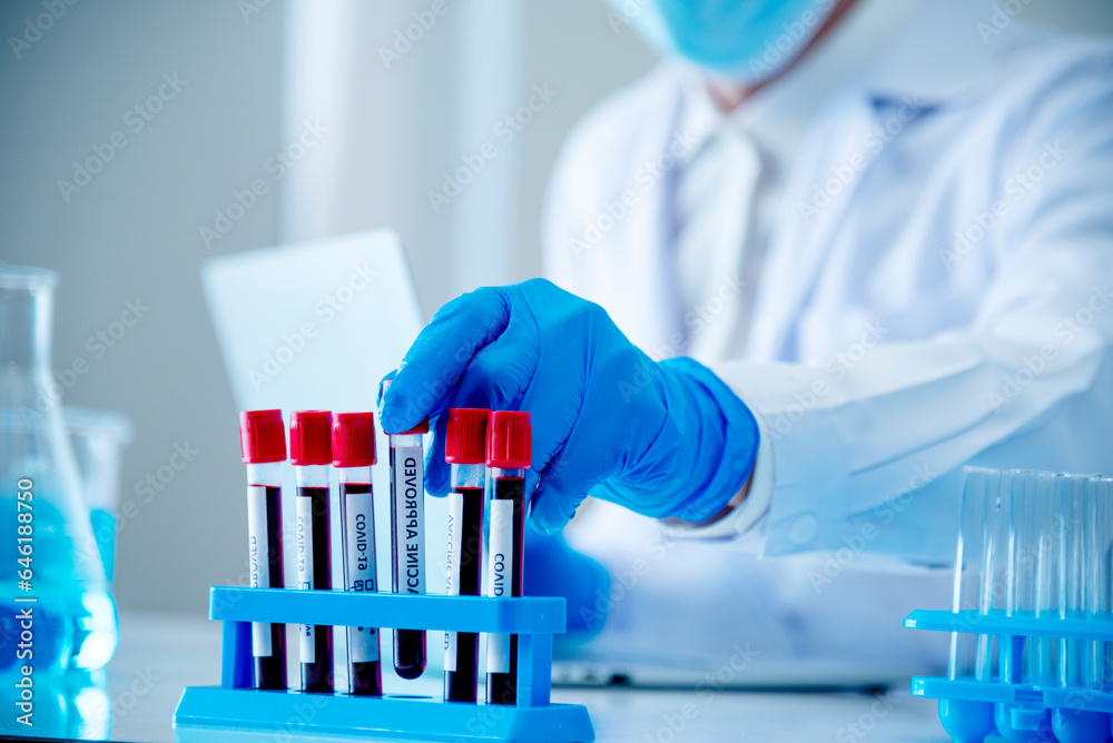 Scientist man holding sample blood test tube in science laboratory. Doctor clinic healthcare technician lab testing blood sample diagnosis. Asian man scientist working in hiv testing medical lab. Scientist man holding sample blood test tube in science laboratory. Doctor clinic healthcare technician lab testing blood sample diagnosis. Asian man scientist working in hiv testing medical lab.