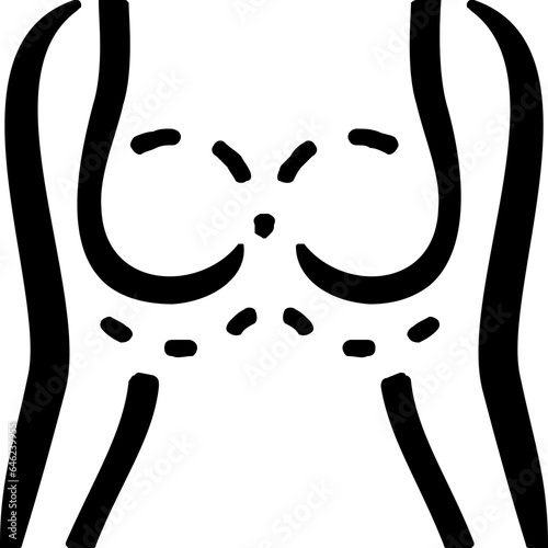 breast augmentation